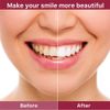 120g SIP-4 Probiotic Toothpaste, Whitening Sp-4 Probiotic Toothpaste Whitening
