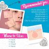 Bye Bye Blemish Acne Drying Lotion 2 Pack Fast Acting Pimple Treatment