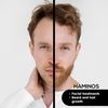 Head 0.25 mm compatible with Haminos Derma Roller, 140 Titanium Needles (Head 0.25 mm)