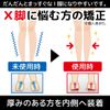 PhoenixSole Insoles for X-Leg and O-Leg Correction, Set of 2, Unisex, Silicone Padd/Cushion Material/Posture Adjustment