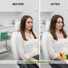 Exosome Scalp Care Complex Kit with Botanical Nutrients