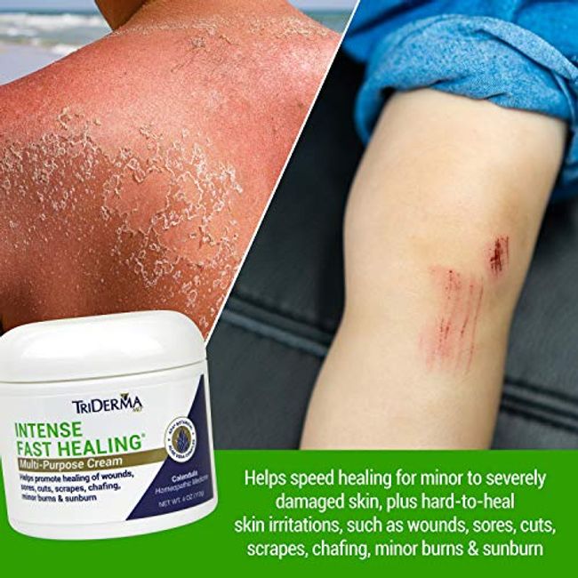 TriDerma Pressure Sore Relief Cream Speeds Healing of Bed Sores, Pressure  Sores, Ulcers, Scrapes and Chafing, 4 ounces