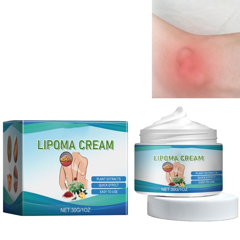 LipomaCure Soothing Ointment,Herbal Lipoma Lumps Removal Cream,Instant ...