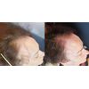 DAMO hair loss control scalp Tonic