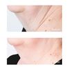 Perricone MD Cold Plasma Plus+ Sub D/Neck