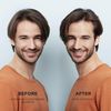 Nioxin 3 Part Trial Kit System 2