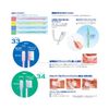 DENT.EX Slimhead ll 34M