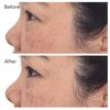 Murad Correct & Protect Broad Spectrum SPF 45 | PA++++ 30ml