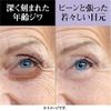 Prandu Quick Ayang Eye Serum