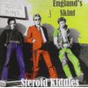 Englands Skint
