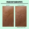 Peace Out Dark Spots Microstructure Dots for Hyperpigmentation 2 Count Pack