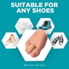 Homergy Hammer Toe Straightener Corrector Splint - 4 Broken Toe Wraps, Brace Orthopedic Separator, Cushioned Bandages, Heal Wrap Toe Straighteners for Crooked Toes, Align Hallux Valgus (Beige)