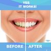 MySmile Teeth Whitening Kit 5PC Gel 5LED Light Accelerator With Silicone Tray