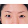 cogit eyelid tape for night use