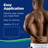 Salonpas Large Pain Relief Patch, 9 Count - Pack of 2