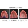 Adjustable Denture Brush Mango