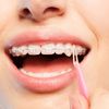 JMU Orthodontic Elastics 3/16 Inch Medium 4.5oz 500 pack Intraoral Elastic Bands Latex Free Dental Rubber Bands Made in USA