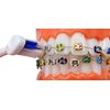 LBailar Braces Toothbrush Rechargeable with 4 Heads Bonus 2 AFTERCARE