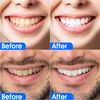 Advanced 5D Teeth Whitening Strips for Sensitive Tooth 14 Sessions for 5D White