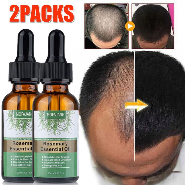 2PCS Rosemary Essential Oil For Hair Growth 100% Pure Natural Therapeutic Grade