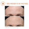 Dr. Dennis Gross Alpha Beta Ultra Gentle Daily Peel: for Dehydrated or Sensitive Skin, Uneven Tone or Texture, Fine Lines or Enlarged Pores (30 Treatments)