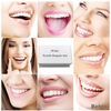 Tooth Repair Kit for Fixing the Missing Chipped and Broken Tooth Gap Temporary Replacement Thermal Beads and Fake Teeth Brace Mold