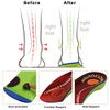 Half Type Footbed Sports Insole, Arch Support, Memory Foam Cushion, For Flat Feet, Open Feet, Foot Cushion, X Legs, O Legs, Shock Absorption, Barefoot Feeling, Pain Relief, Standing Work
