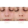 Clarisonic Facial Exfoliating Brush Head Compatible with Mia Smart/Profile Uplift Devices Only