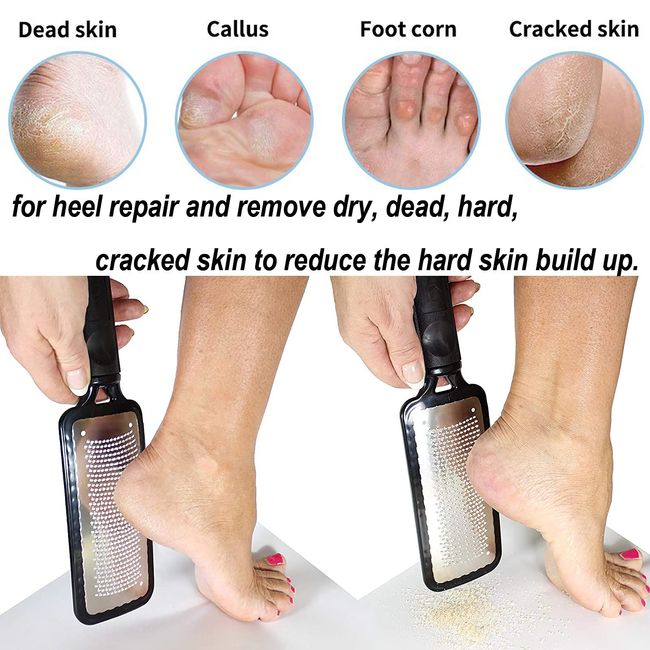 Pedicure Rasp Foot File Callus Remover For Hard And Chapped Corns