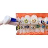 LBailar Braces Toothbrush| Soft Bristle Orthodontic Toothbrush for Cleaning Ortho Braces | U Shaped Portable Toothbrushes for Braces| Set of 4