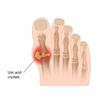 advanced gout relief - Uric Acid Formula 1430mg 1B - celery extract