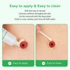 ZnnaYoha Stoma Skin Barrer Paste,Ostomy Paste 2 oz Tube (1 Pack)