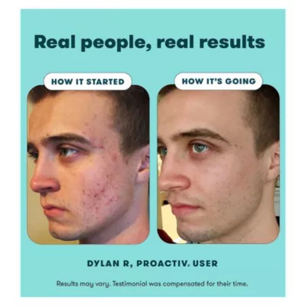 Proactiv Solution Anti Imperfection Hydrator 90ml