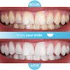 Purean Teeth Whitening Oxystrips - 40 Pure Atomic Oxygen Releasing White Strips - 20 Treatments