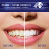 GuruNanda Teeth Whitening Strips with Coconut Oil - 14 Enamel Safe Strips for Sensitive Teeth - Non-Slip, Dry Strip Technology for Whiter Teeth - 7 Professional Treatments with 30 Minutes Fast Results