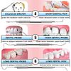 Dental Tools To Remove Plaque and Tartar, Professional Teeth Cleaning Tools, Stainless Steel Dental Hygiene Oral Care Kit with Plaque Remover, Tartar Scraper, Tooth Scaler, Dental Pick - with Case
