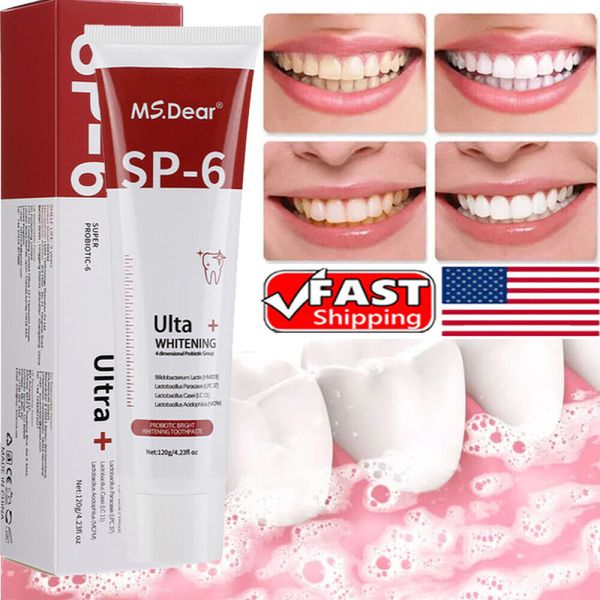 SP-6 Toothpaste, Whitening Sp-6 Toothpaste, Sp-6 Probiotic Whitening Toothpaste