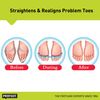 Profoot Care Flex-tastic, Fits All