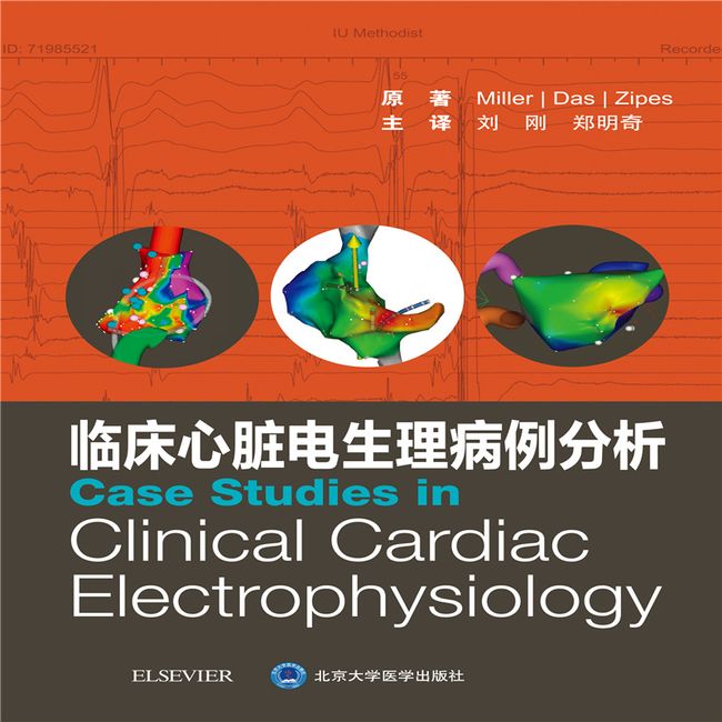 临床心脏电生理病例分析