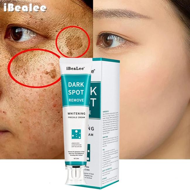 Domestic shipment (same-day delivery) KORELAN Age Spot Vita e Melasma Removal Cream Age Spot Blemish Skin Restoration, 20ml, 1ea