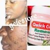 X 6 Jar QUICK clear Pink Sun Burn, & More Face Cream 100% AUTHENTIC