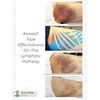 Kinesio Classic Fan Cut Edema Strips 12 Pack