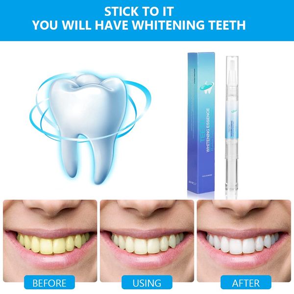 ACWOO Teeth Whitening Essence, 2 Stück Zahnaufhellung Stift, Sanftes Teeth Whitening Stift, Zahnaufhellung Gel, Bleaching Stift, Schmerzfreies Zahnbleaching, Effektiv Flecken Entfernen