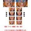 Instant Smile Teeth DX-M 1 Pack (x1)
