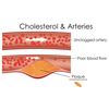 Lower Cholesterol - NEW CHOLESTEROL RELIEF FORMULA - lowers LDL - 1 Bottle