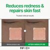 INFODPLUS XCESPI316™ REPAIR CREAM 50ml