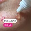 BeOnMe: Face Spot Treatment 15 ml