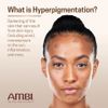Ambi Even & Clear Fade Cream, Hyperpigmentat