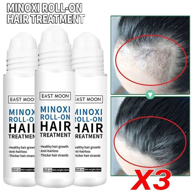 3 Pack Hair Growth Treatment Serum Minoxi Roll-on Regrowth Nourishing Hair Care