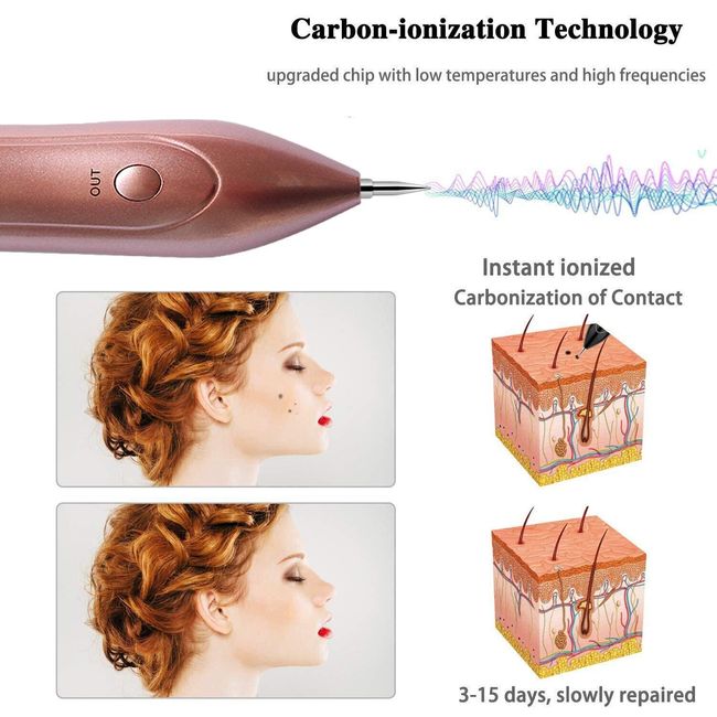 Electric Mole Remover Pen Body Facial Skin Tag Freckle Dot Removal Usb Red